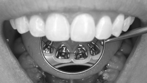 ortodoncija mala nova bw.jpeg